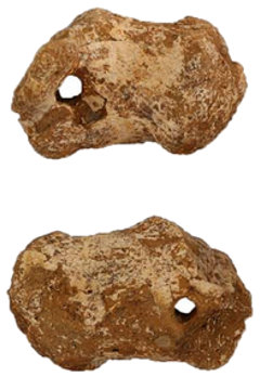 Heel bone of a crucified man